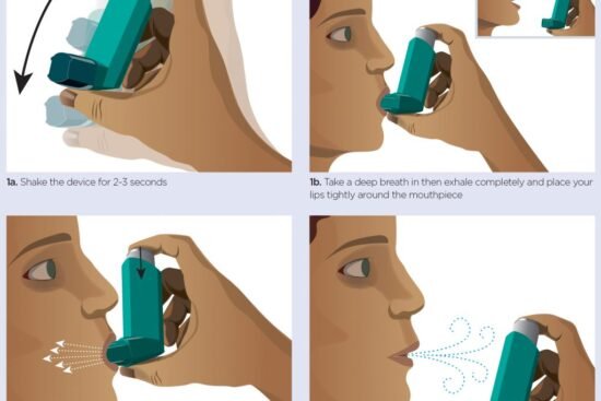 can you explain the correct inhaler techniques 1