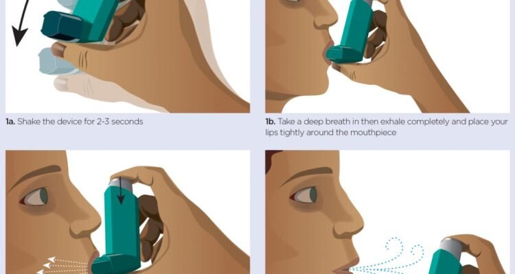 can you explain the correct inhaler techniques 1
