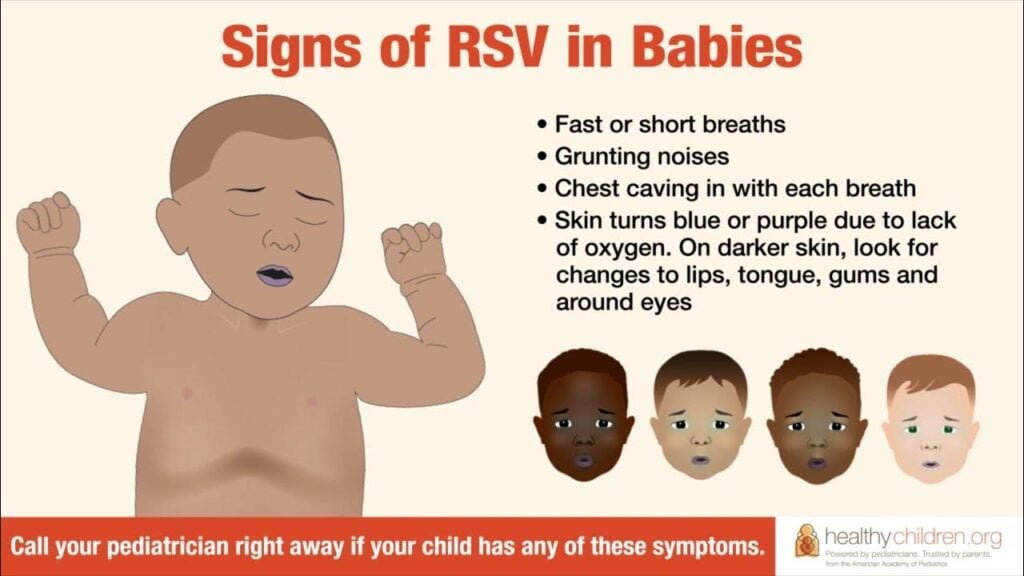 Can You Explain The Signs Of Respiratory Distress In Infants And Children?