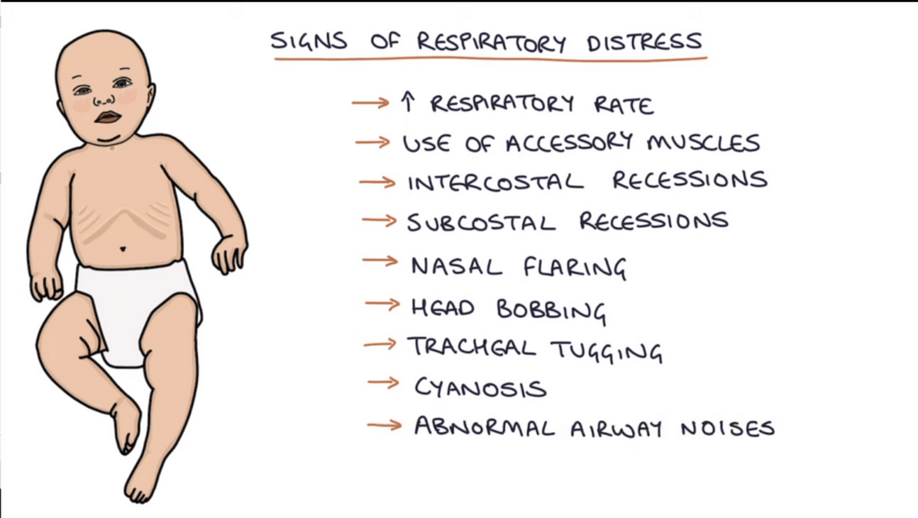 Can You Explain The Signs Of Respiratory Distress In Infants And Children?