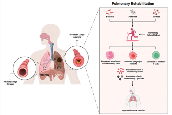 does-pulmonary-rehab-improve-lung-function