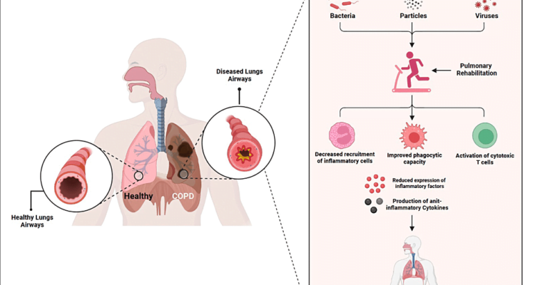 does-pulmonary-rehab-improve-lung-function