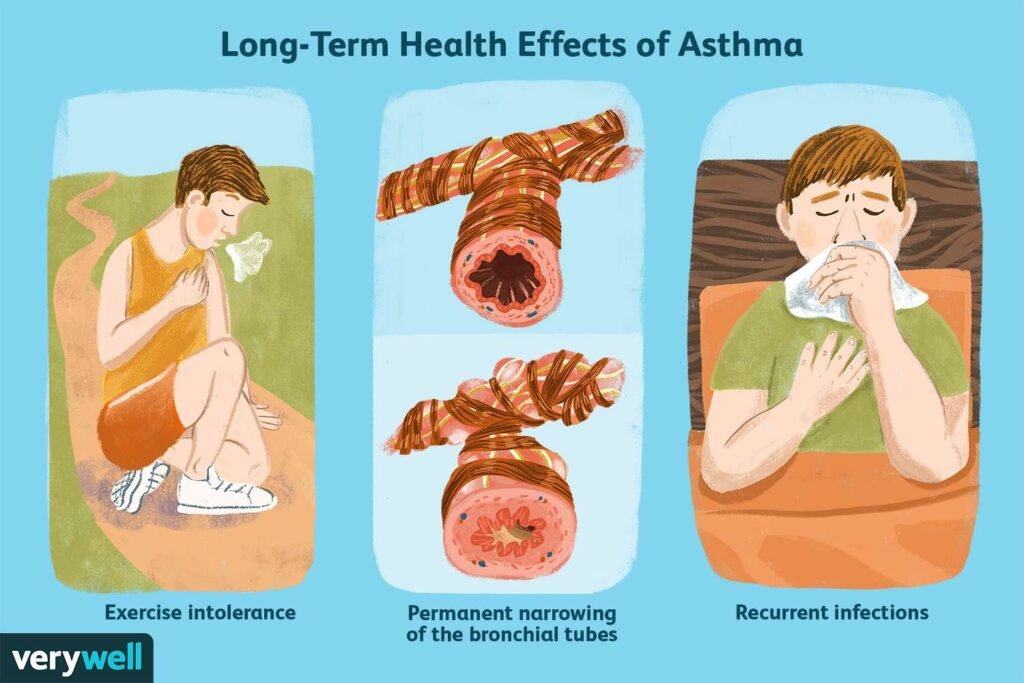 What Is Daily Life Like With Asthma? What Is Daily Life Like With Asthma?