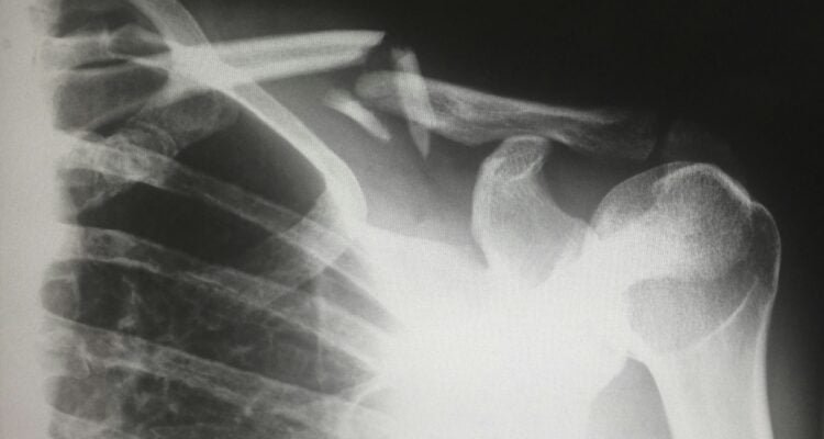 what-precautions-should-be-taken-when-administering-oxygen-therapy-to-elderly-patients